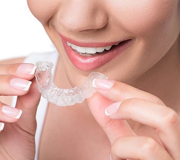 Clear Aligners in Staten Island, NY