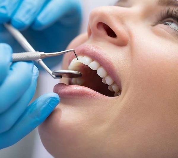 Dental Bonding in Staten Island, NY