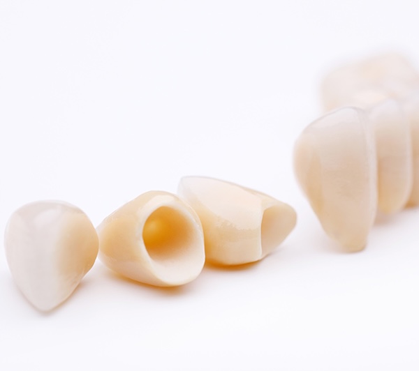 Dental Crowns in Staten Island, NY
