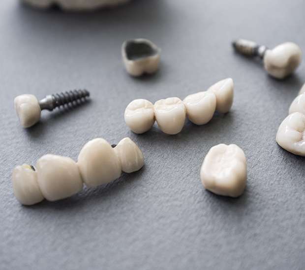 Staten Island The Difference Between Dental Implants and Mini Dental Implants