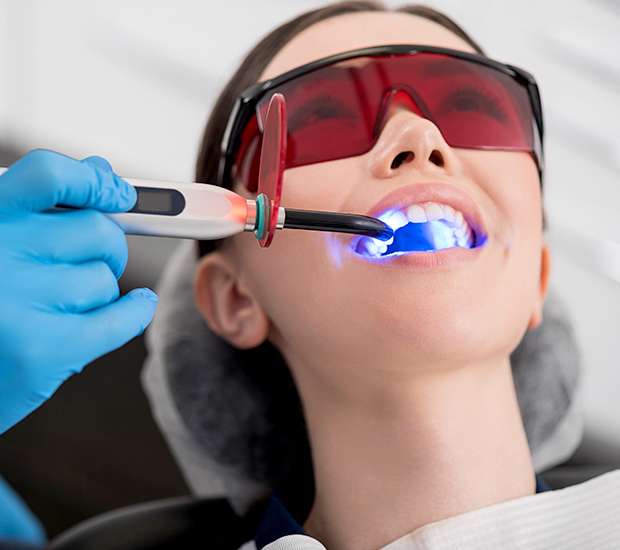 Staten Island Professional Teeth Whitening